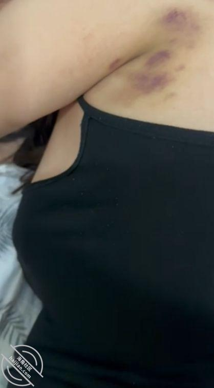 (原创)痛恨家庭暴力!后妈被我爸打的都是淤青,在我的追问下哭的一塌糊涂… 封面